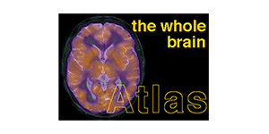 the whole brain Atlas